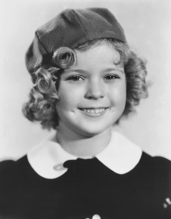 Hollywoodzki uśmiech 10-letniej Shirley Temple to zasługa licówek
