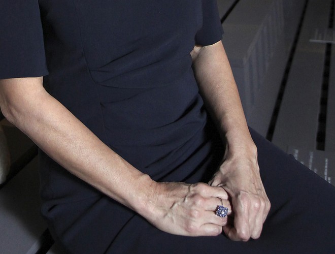 Dłonie połóż na kolanach. Staraj się unikać nadmiernej gestykulacji. Trzymając ręce na kolanach będziesz wiedzieć gdzie się znajdują.