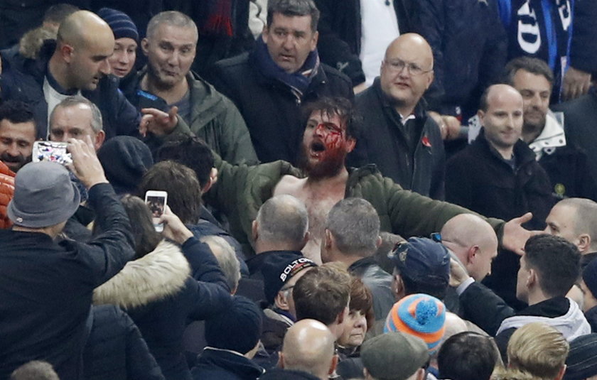 Pseudokibice bili się na Wembley. Krwawa jatka na Anglia – Szkocja