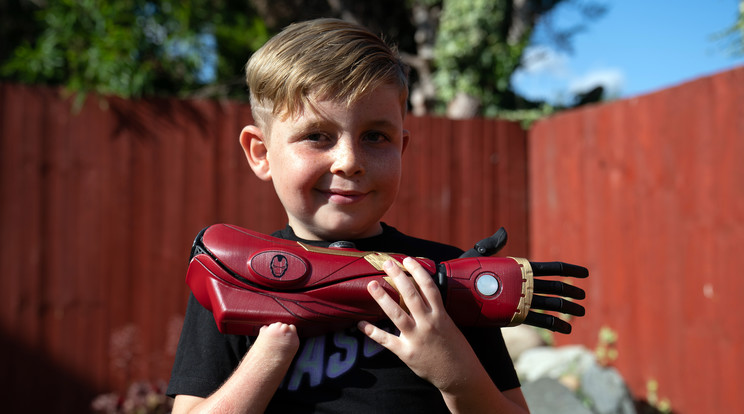 A 7 éves, kéz nélkül született fiú Ironman-stílusú "robotkar"-t kapott / Fotó: Northfoto