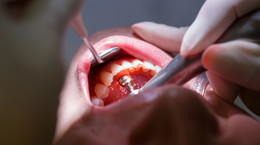 Jak rozpoznać złego dentystę. Lekarze podpowiadają, co powinno nas zaniepokoić