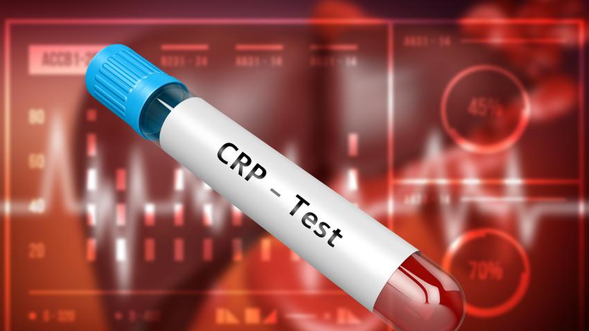 CRP-érték: milyen tünetek jelzik, ha krónikus gyulladás van a szervezetben?  Itt a válasz! | EgészségKalauz
