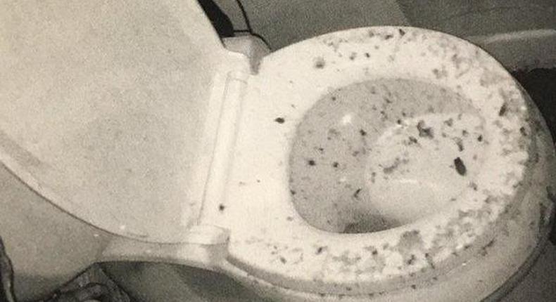 Woman sues after toilet exploded in her face 