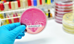 Bakteria E. coli - objawy zakażenia, profilaktyka
