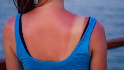 Zobacz, zanim kolejny raz spieczesz się na słońcu: TAKIE uszkodzenia w skórze powoduje zbyt długie opalanie