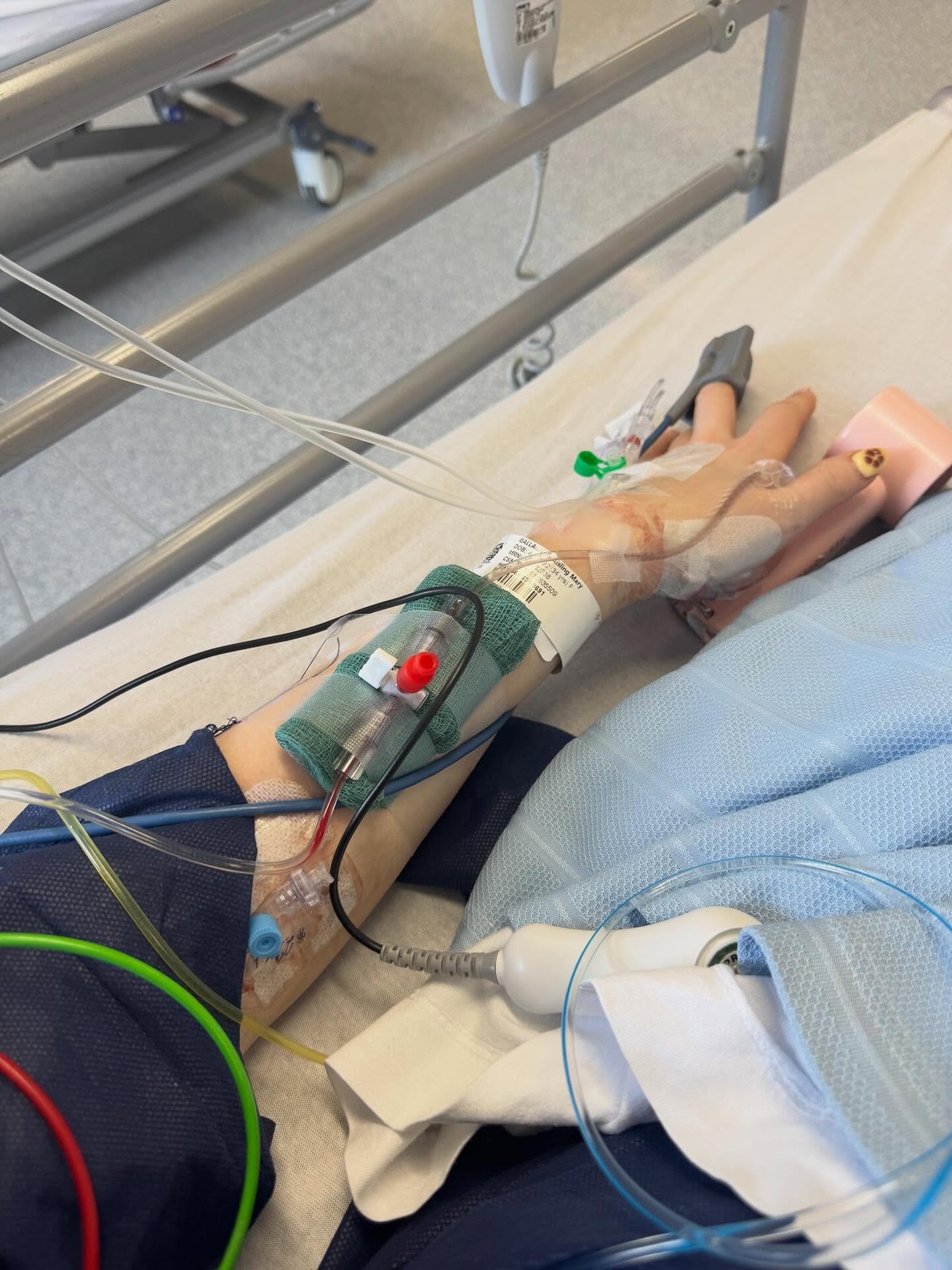 Mladá Aisling si prešla rakovinou konečníka v druhom štádiu.