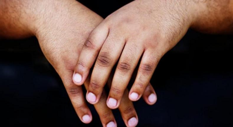 3 home remedies to get rid of dark knuckles