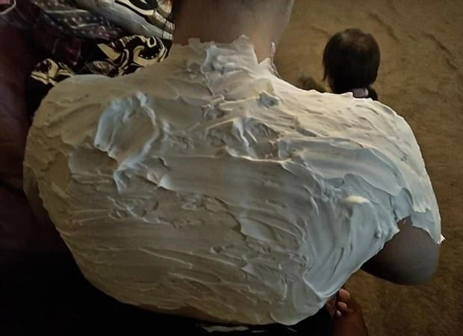 Sindi sa penom na leđima