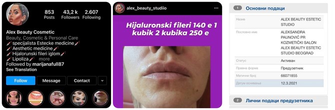 Kozmetički salon u kome se rade nedozvoljeni estetski zahvati