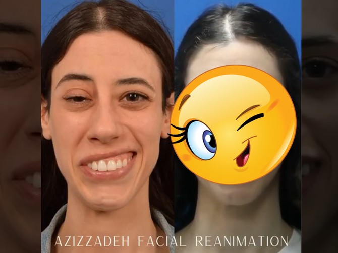 Transformacija o kojoj se priča na Instagramu