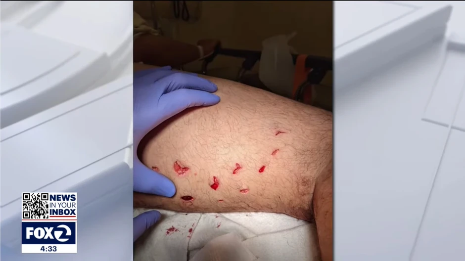 ajkula 2 foto Youtube KTVU FOX 2 San Francisco