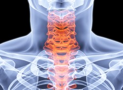 Sprawdź, co robić, by unikać złamań