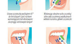 Szczotkowanie zębów - właściwy sposób, częstotliwość wymiany szczoteczki, rodzaje szczoteczek