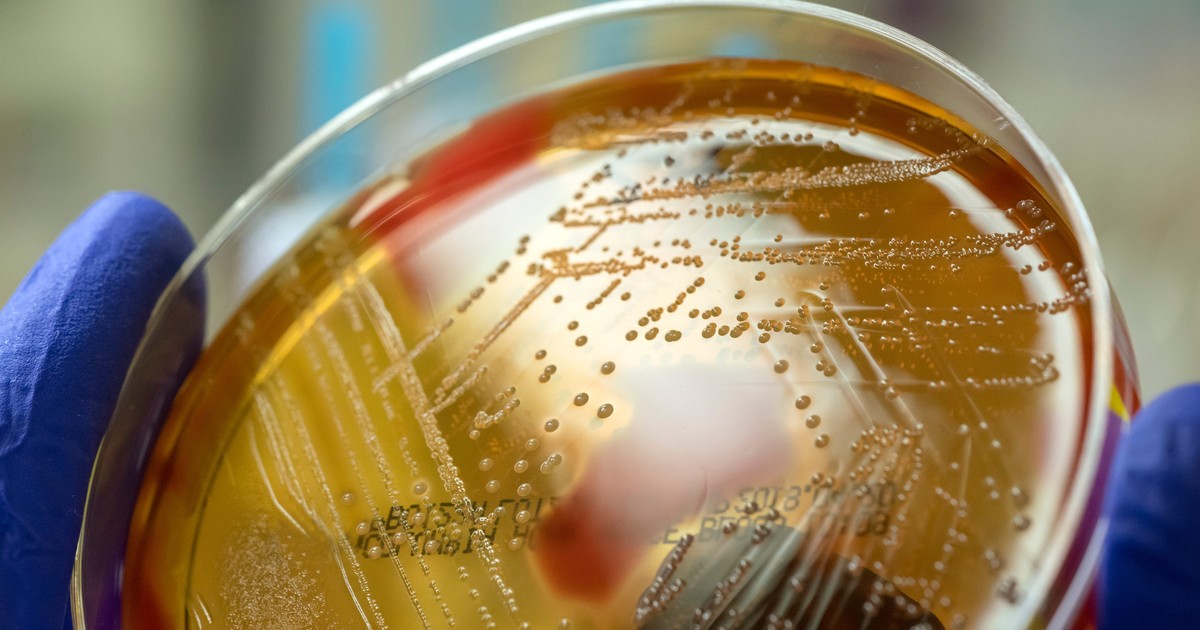 Strep A is surging in the UK and has already killed at least 19 ...
