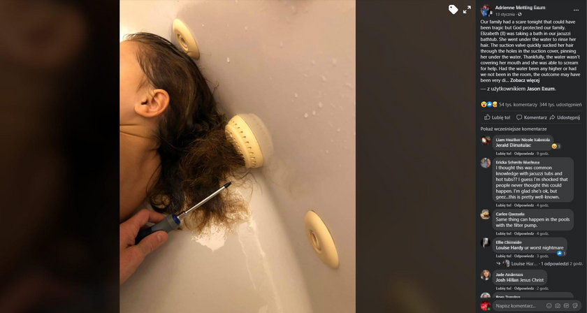 Wanna z hydromasażem wciągnęła włosy dziecka