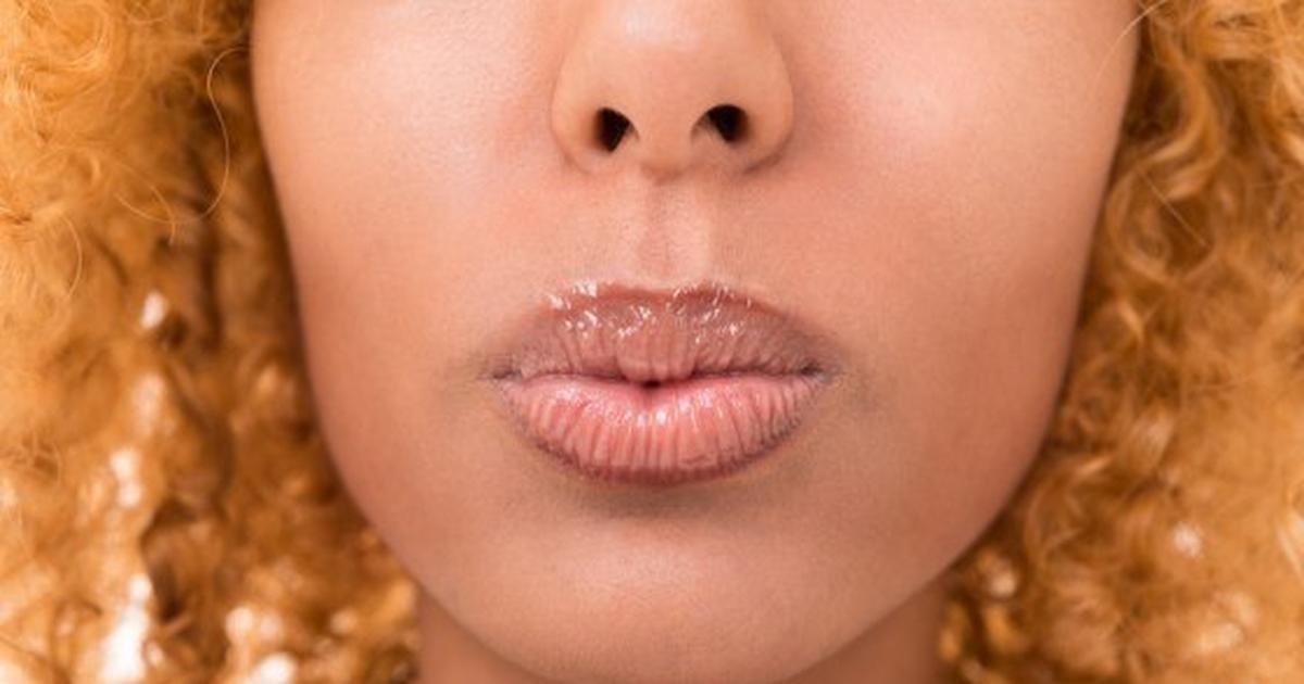 Herpes 5 Things To Know About Venereal Disease [article] Pulse Nigeria