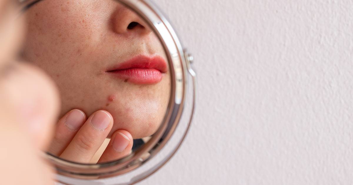 Obsesja na punkcie skóry. "Brałam na imprezy żel do mycia twarzy"