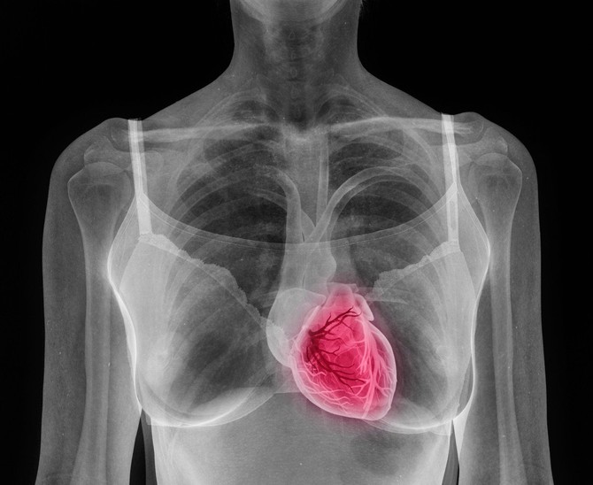 Kardiološki pregled počinje od EKG-a, a ako lekar proceni da je potrebno, slede – ultrazvuk srca, holter EKG-a, test opterećenja, koronarografija, magnetna rezonanca srca, holter krvnog pritiska...
