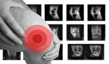 Porcmegújulás: valóban vissza lehet növeszteni a porcokat?