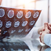 Nem csak fejfájás: 12 meglepő tünet, ami agydaganat jele is lehet