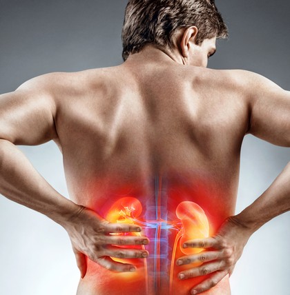 Nierensteine können heftige Koliken verursachen. Beim Verdacht auf die Erkrankung oder bei akuten Schmerzen sollte man einen Arzt aufsuchen.