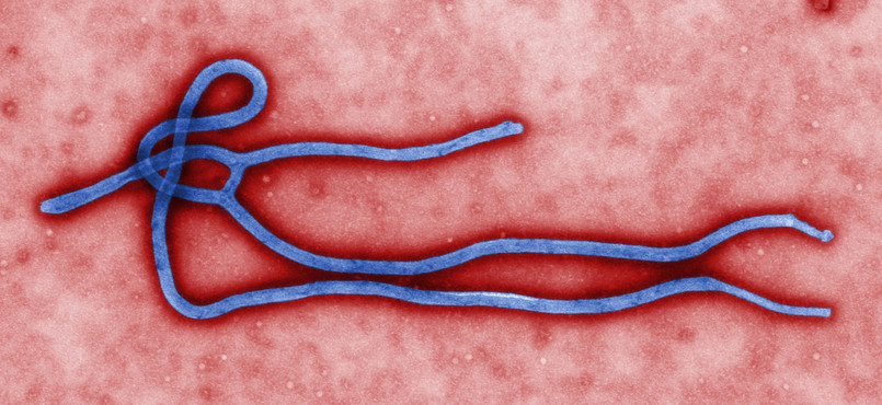 Wirus Ebola pod mikroskopem