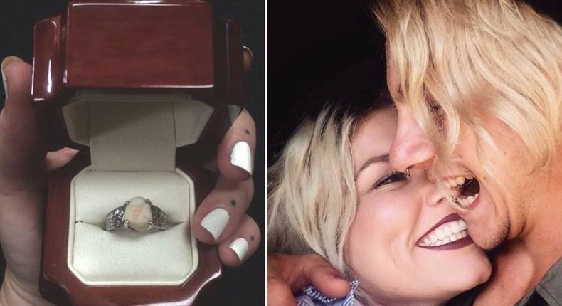 Man uses his wisdom tooth as engagement ring to propose to his fiancee 