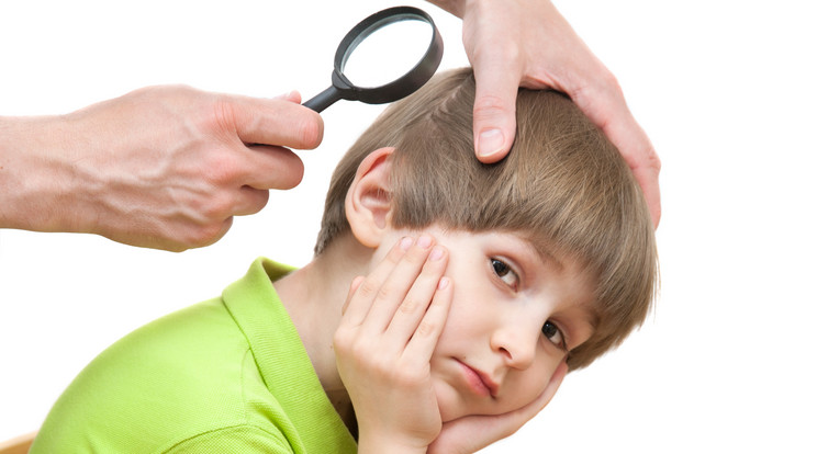 Akkor is nézzük át hetente a gyerekek haját, ha fej- vagy fülvakarás nem hívja fel a figyelmet a bajra / Fotó: Shutterstock