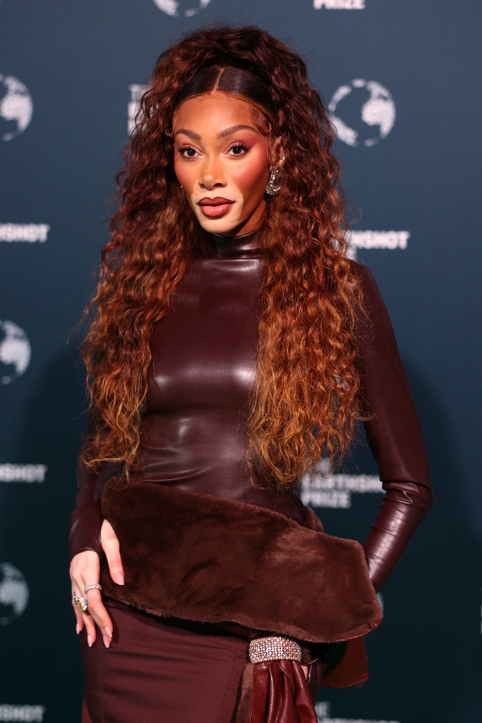 Gyerekként zaklatták, ma a világ egyik legkeresettebb modellje Winnie Harlow