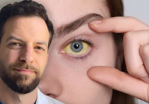 Žutica sama po sebi nije dijagnoza, ona je znak da treba pronaći uzrok, kaže dr Stevan Milenković 