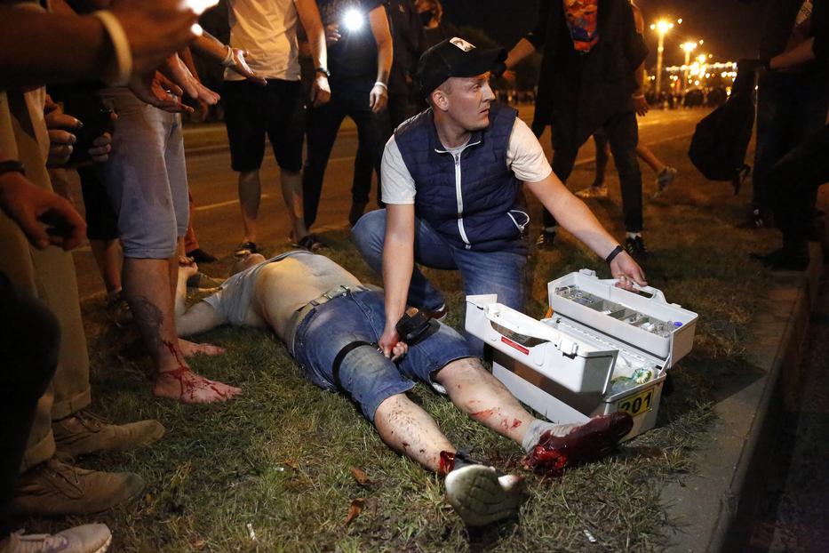 Sérültet tüntetőt ápol egy mentős Minszkben/ Fotó: EPA/TATYANA ZENKOVICH
