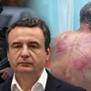 Kurti, prebijeni Nenad Rašković 