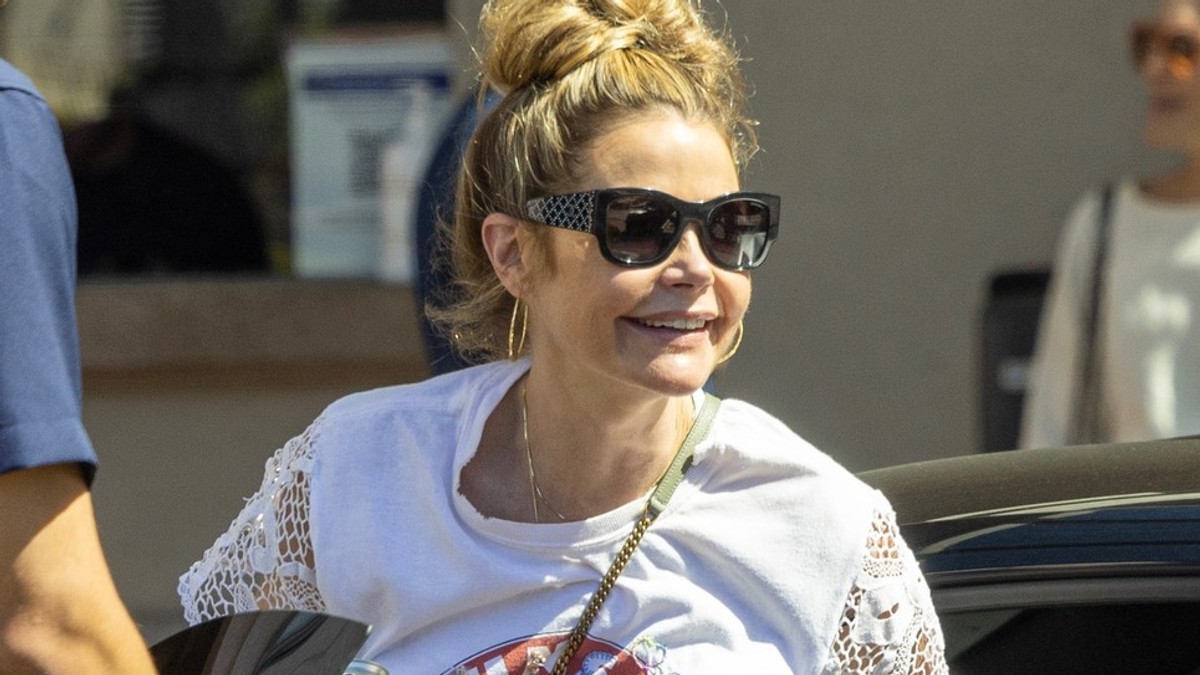 "Nisam htela da imam ćureći vrat": Holivudska glumica priznala šta je sve operisala