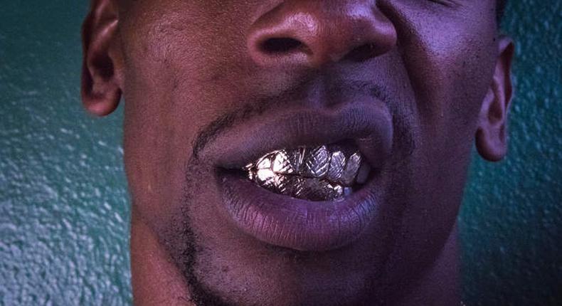 Man, 22, lands in hospital as silver grillz worn to decorate teeth gets stuck in his lungs