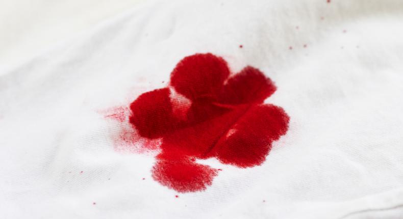 How do you get blood stains off the sheets? [eHow]