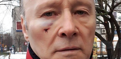 Znany aktor wdał się w bójkę w Warszawie. Sprawę wyjaśnia policja