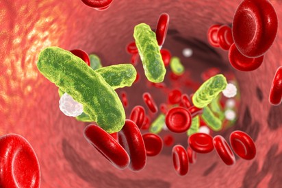 A nő 2 hónapon belül vesztette el szüleit szepszisben - hetekkel később nála is diagnosztizálták a gyilkos kórt