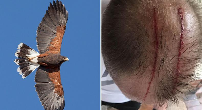 man attacked by hawk jogging
