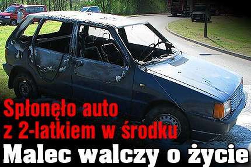 Spłonęło auto z 2-latkiem w środku. Malec walczy o życie