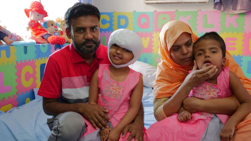 Szétválasztott sziámi ikrek: Rabeyán sürgős műtétet kellett végezni