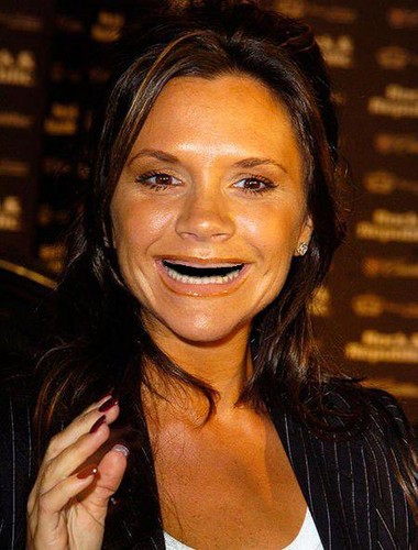 Gwiazdy bez zębów hitem Internetu