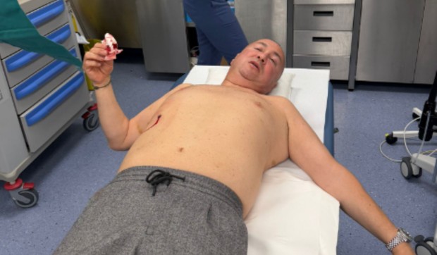 Prva slika Đanija nakon ujeda