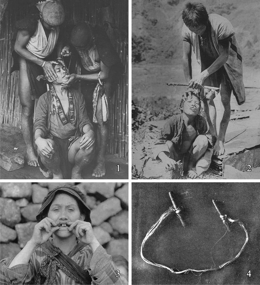 Istorijske slike na kojima se vidi kako su pojedina plemena vadila zdrave zube