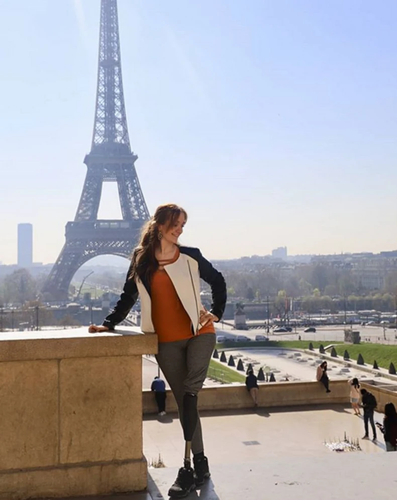 Bojana Ćorilić (24), devojka kojoj je amputirana noga, nakon što je kao slučajna prolaznica upucana tokom masakra u Žitištu, 2. jula 2016. godine.