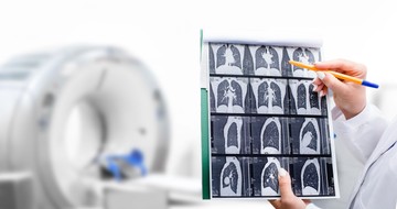 Nőnap alkalmából tüdőrákszűrő napot hirdet az Országos Korányi Pulmonológiai Intézet