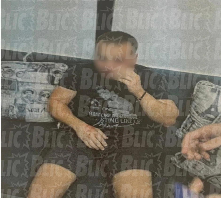 Mitića su odveli u kuću, pa su ga maltretirali da im prizna "ko ga je poslao"  (Fotofrafiju smo blurovali jer su na Mitićevom licu vidljivi tragovi prebijanja)