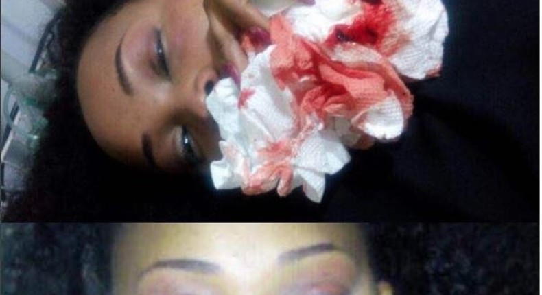 Mercy Aigbe beaten up