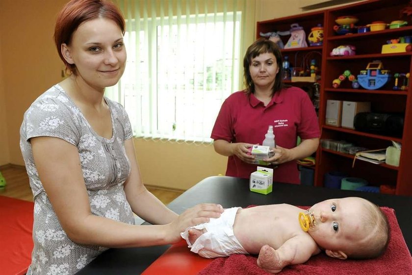 Majeczka już ćwiczy, żeby mieć protezy