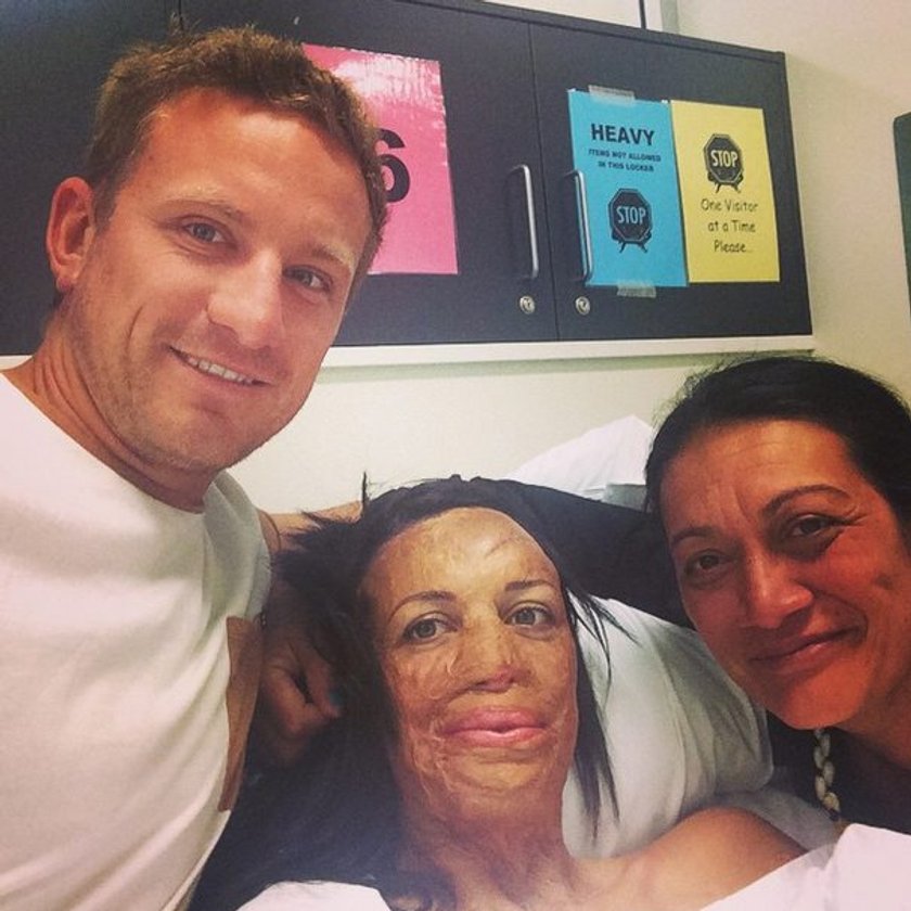 Turia Pitt