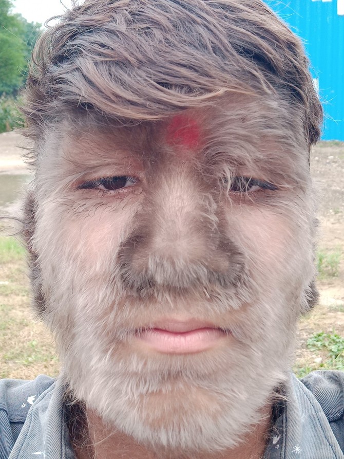 Lalit Patidar